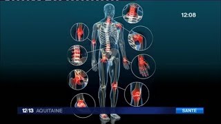 Quels solutions pour soulager les douleurs liées à larthrose [upl. by Jahdiel425]