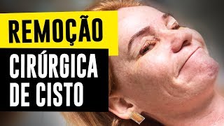 Fiz uma cirurgia de endometrioma e gravei tudo [upl. by Azmuh]