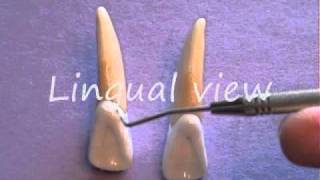 Maxillary Lateral Incisor Anatomy [upl. by Nennahs204]