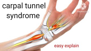 carpal tunnel syndromesymptomstestexercisetreatment in Hindi how treat carpal tunnel syndrome [upl. by Odom]