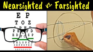 Myopia vs Hyperopia vs Presbyopia  Difference Explained [upl. by Audy]