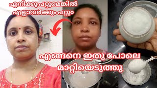 കറുത്ത മുഖവു൦ കരിമ൦ഗലൃവു൦ മാറ്റിയത് ഇങ്ങനെയാണ്how to make pigmentation face pack തെളിവ് സഹിത൦ [upl. by Larentia]