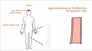 Acute Leukemia  Part 1 [upl. by Leake]