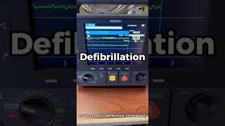 WATCH How to Perform Defibrillation using a Philips Intrepid Defibrillator [upl. by Atled]