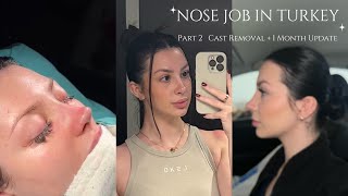 I Got a RHINOPLASTY in Turkey Part 2  Cast Removal  Nose Job 1 Month Update  Dr Sedat Ruzgar [upl. by Vary]