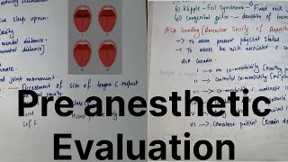 Preanesthetic Evaluation  Anesthesia dene ke Pehle kya kya checkup karte hAllrounderdoctorfalit [upl. by Eisler]