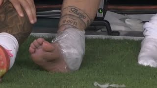 Messi injury vsColombia complete video Copa America 2024 [upl. by Edrock84]