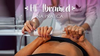 Na prática  HF Alta Frequência Portátil  Ibramed [upl. by Rubie]