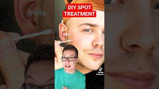 ⚠️DONT TRY THIS AT HOME  DIY Spot Treatment shorts [upl. by Gurolinick]