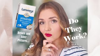 Lumineux Whitening Strips  Honest Review [upl. by Morrie981]