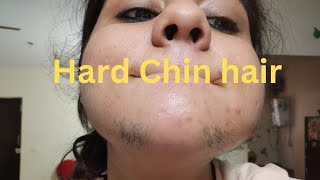 Extreme hard Chin hair Removal मर्दों जैसे बाल तुरंत हटाओHow to remove hard Chin hair [upl. by Aysahc]