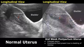 Gynecological amp Obstetric Ultrasound Normal Vs Abnormal Scan  Uterus Ovary Cervix Pregnancy USG [upl. by Littman89]