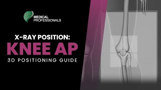 Xray Positioning  Knee AP [upl. by Materi]