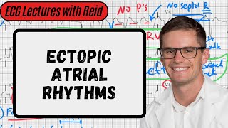 Ectopic Atrial Rhythms  Day 10 ECG Challenge [upl. by Meehan]