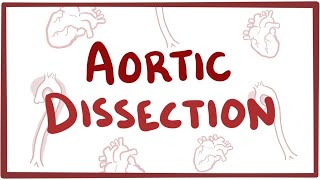 Aortic Dissection  causes symptoms diagnosis treatment pathology [upl. by Pattie575]