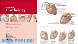 Netters CARDIOLOGY 2nd EDITION BY Marschall S Runge  George A Stouffer and Cam Patterson pdf [upl. by Pierson648]