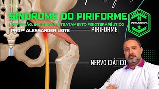 Síndrome do Piriforme  Definição Incidência e Tratamento Fisioterapêutico [upl. by Nahtahoj]