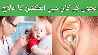 how to manage ear infection in children [upl. by Anerroc858]