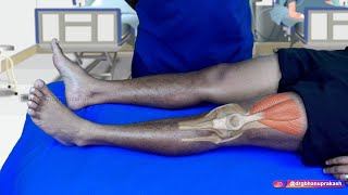 Knee Joint Examination  OSCE Orthopedics  Clinical essentials [upl. by Eenahc551]