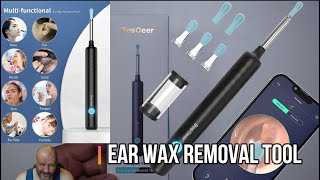 Ear Wax Removal Tool [upl. by Ramled430]