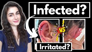 Doctor explains Is your piercing infected How to care for a new cartilage piercing [upl. by Bonilla]