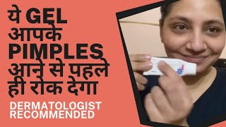 Best Gel to Cure Pimples amp Acne  Effective Gel to Cure Acne  Hritu Saklani [upl. by Noffets]