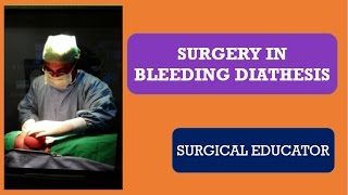 SURGERY IN BLEEDING DIATHESIS [upl. by Niraa]