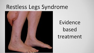 Restless Leg Syndrome evidence based treatment [upl. by Akcinat585]