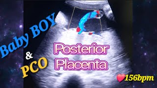 Genderreveal with Baby Movements Why amp When  Posterior Placenta with baby💙  PCO  Polycystic ovary [upl. by Amocat807]