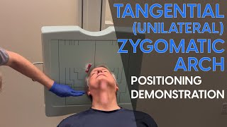 Tangential Unilateral Zygomatic Arch Radiographic Positioning Demonstration [upl. by Annairol]