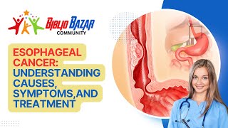 🩺 Understanding Esophageal Cancer Symptoms Treatment and Care 🩺 [upl. by Ruel]