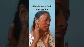 Blemishes amp Dark spots reduce with red sandalwood 😍 shorts viral beauty [upl. by Aiksas]