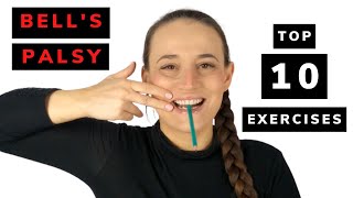 Bells palsy exercises supporting recovery [upl. by Kyle541]