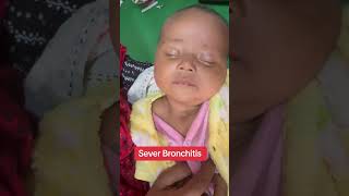 Severe Bronchitis drataurrahman newbornbaby baby crezyboy [upl. by Devin]