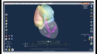 Introductory lecture on Epicardio Simulation™  ECG [upl. by Dionne]