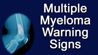 Multiple Myeloma Warning Signs [upl. by Eveam682]