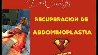 Recuperación de Abdominoplastia  Dr Cortes [upl. by Younglove]