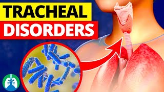 7 Types of Tracheal Disorders  Conditions of the Trachea [upl. by Mandi]