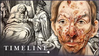 The True Terrors Of Tudor Medicine  Hidden Killers  Timeline [upl. by Press975]