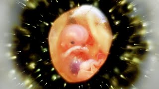 Foetus and Womb Protection Baby Healing Frequency [upl. by Tormoria193]