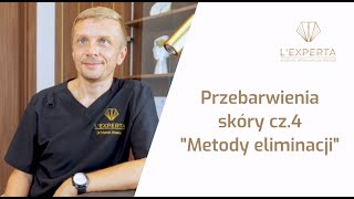 Przebarwienia skóry  jak usuwać  LExperta [upl. by Acisset760]