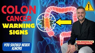 Does red meat cause colon cancer Colon Cancer Symptoms You Should Ignore [upl. by Suiradal]