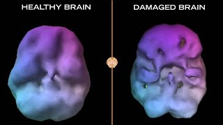 What Happens to Your Brain When You Play Contact Sports [upl. by Aleakim]