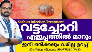 വട്ടച്ചോറി മാറാൻ  Vattachori Maran  Scabies infection CausesSymptomsTreatment  DrVisakhKadakkal [upl. by Ahsemo]