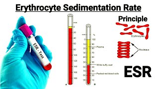 ESR test in hindi  Mechanism of ESR  Factor affecting ESR  Full information about ESR in hindi [upl. by Areemas]