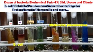 Various Bacteria Biochemical Tests E coli KlebsiellaPseudomonasAcinetobacterProteusMongenella [upl. by Symons]