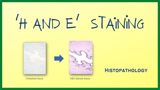 H amp E Staining  Hematoxylin and Eosin stain  Histopathology  Hindi [upl. by Kaela]