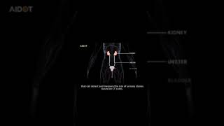 URO dot AI AI based urinary stone detection system [upl. by Nochur]