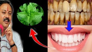 Magical Teeth whitening home remedy get whitening teeth at home in 5 minutes [upl. by Revart]