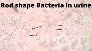 Rod shape Bacteria in urine  Motile and non motile  medicallabtechnologysajal6903 [upl. by Anegue107]